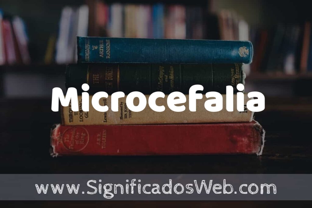 Concepto de Microcefalia ▶️¿Que es? Definición y Significado