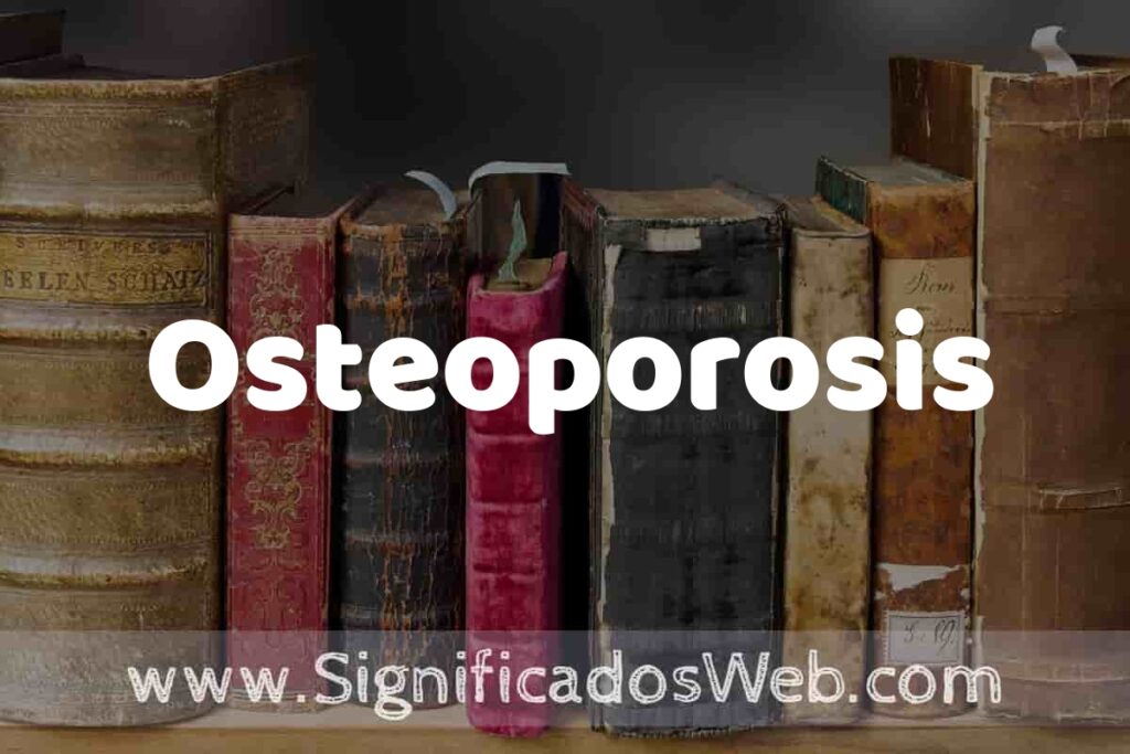 Definición de Osteoporosis: Que es, 5 Ejemplos, Tipos y Para que Sirve + Sinónimo y Significado
