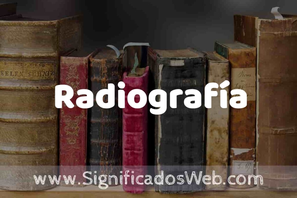 Definición de Radiografía: Que es, 5 Ejemplos, Tipos y Para que Sirve + Sinónimo y Significado