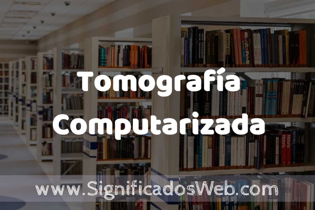 Concepto de Tomografía Computarizada ✔️ Significado y Definición