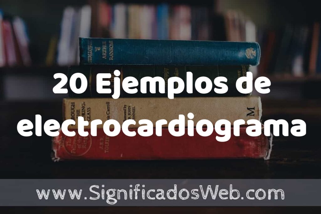 20 Ejemplos de electrocardiograma ▶️ Tipos, Definición y Análisis