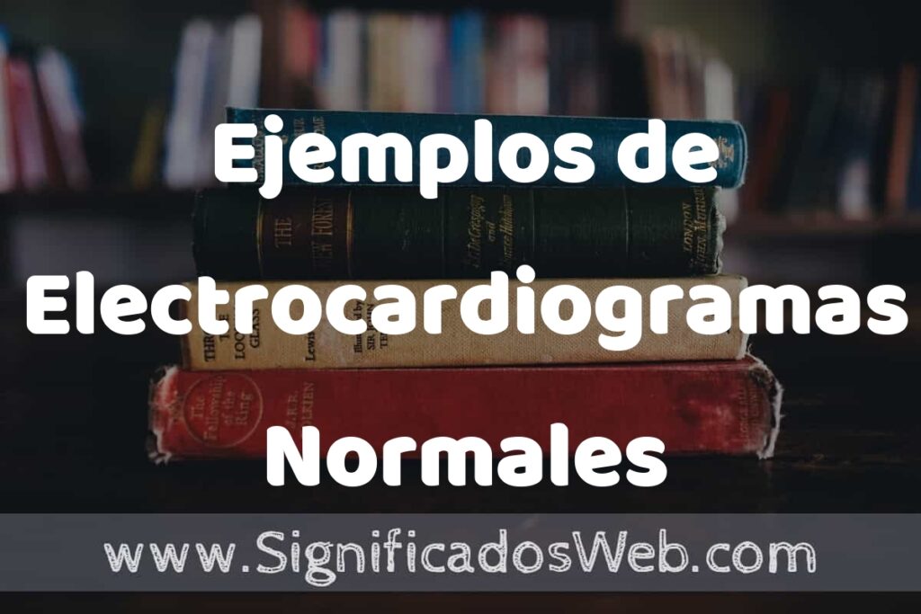 50 Ejemplos de Electrocardiogramas Normales ▶️ Características, ¿que es? COMO USAR